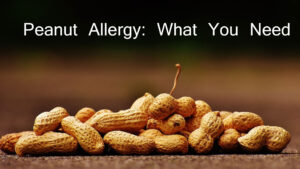 Peanut Allergy What You Need to Know
